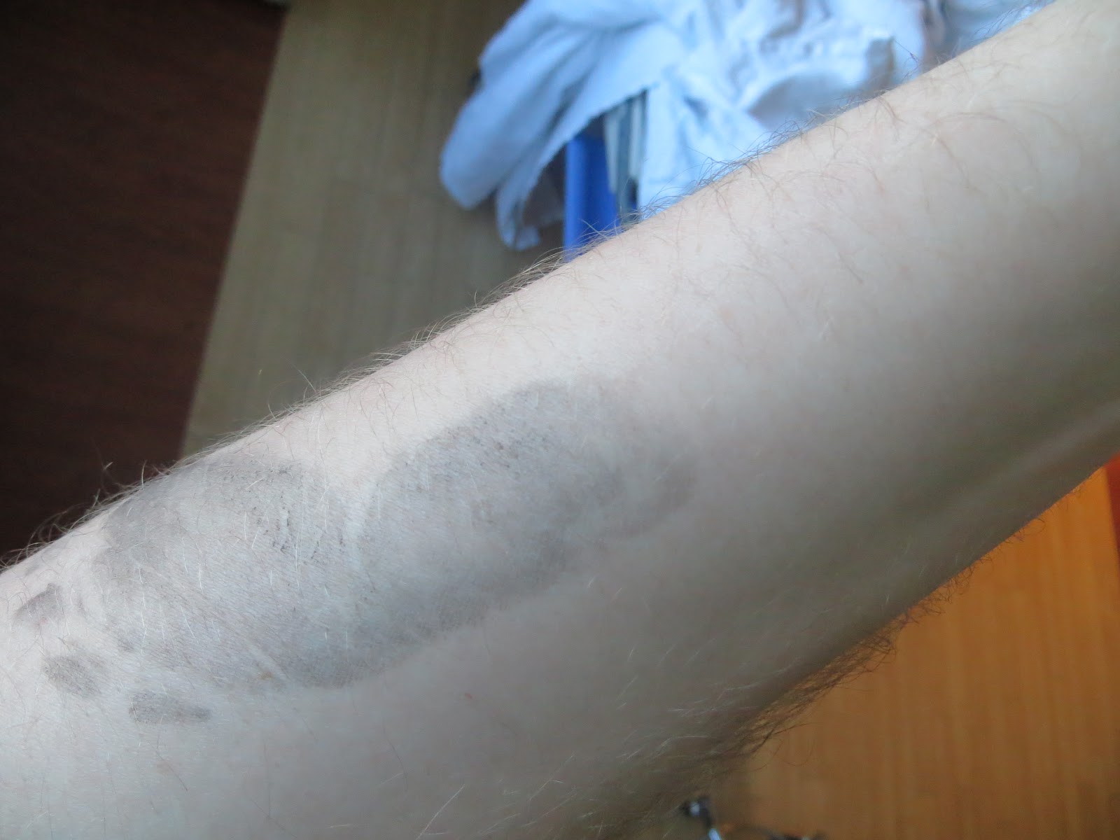 Charlie's Footprint on Daddy's arm